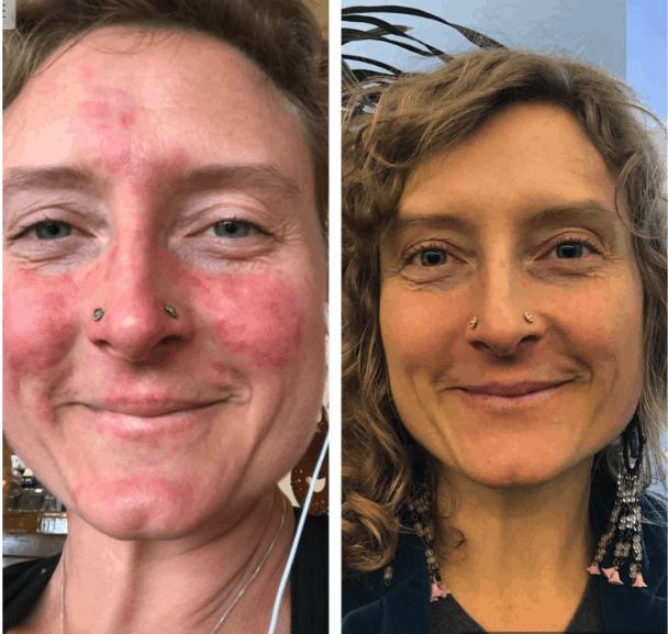 Mt. Capra's Clean Whey Protein As Part of Victoria's Healing Journey